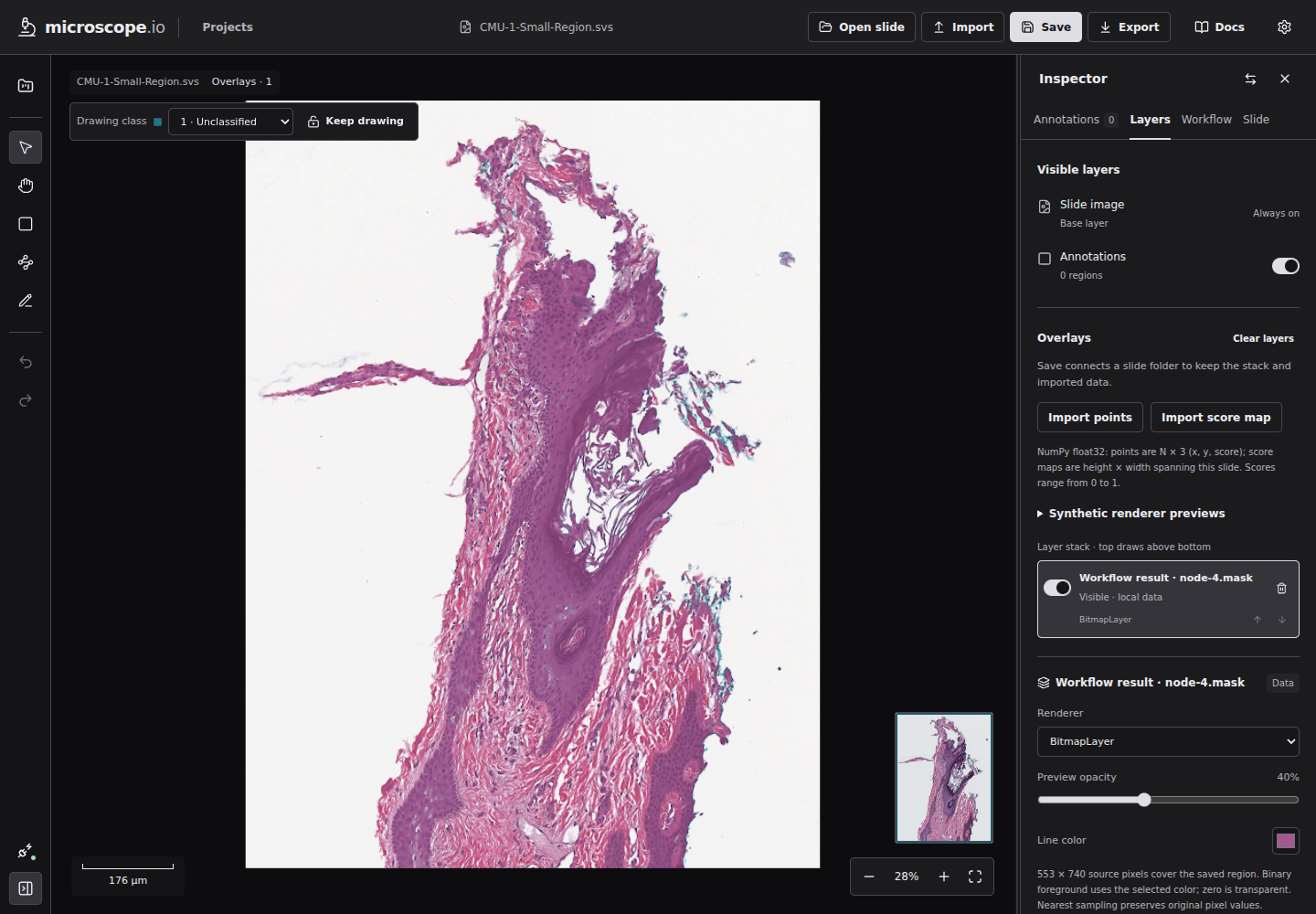 The updated Layers inspector showing the base slide, annotation visibility, overlay import controls, and a workflow result, with synthetic test tools collapsed.