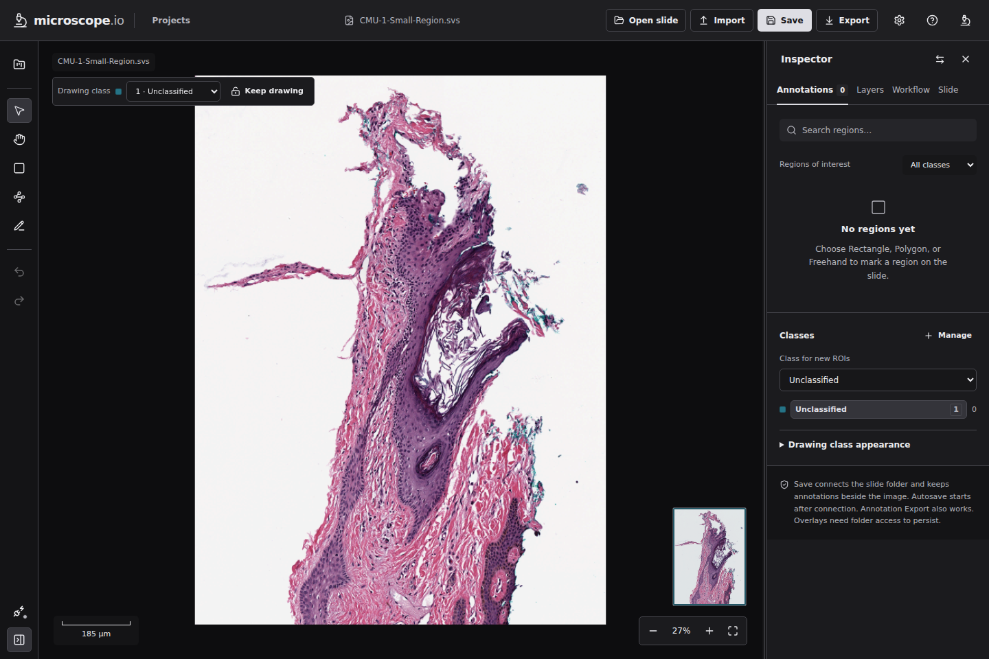 Microscope viewer with the public CMU example loaded and its slide metadata visible.